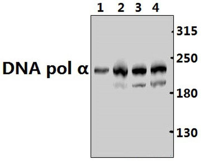 POLA1 Antibody in Western Blot (WB)