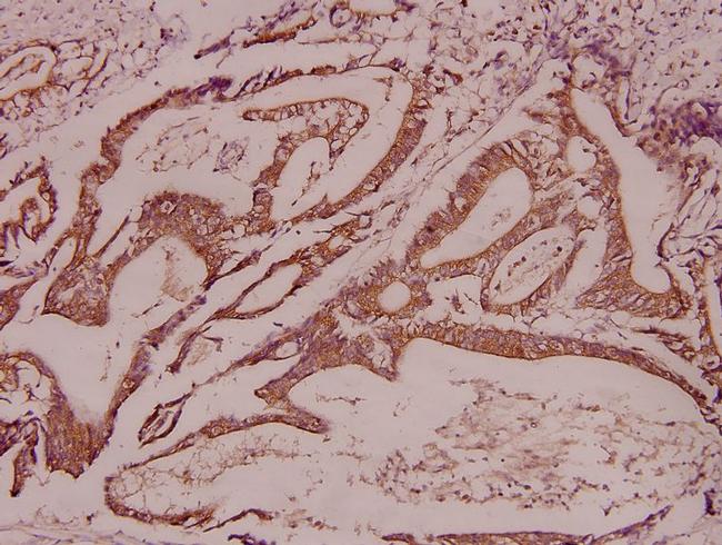 CDK11B Antibody in Immunohistochemistry (Paraffin) (IHC (P))