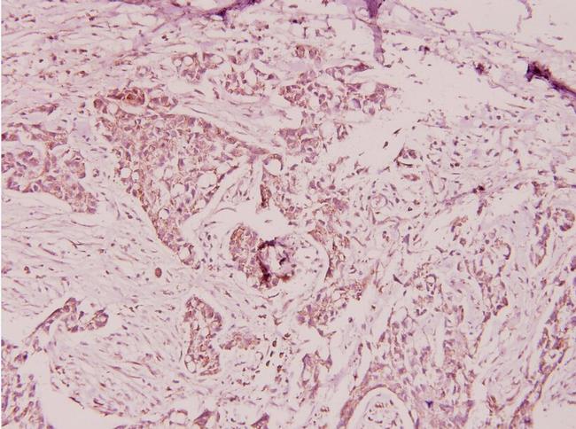 PTX3 Antibody in Immunohistochemistry (Paraffin) (IHC (P))