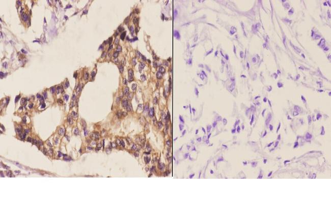 MEK6 Antibody in Immunohistochemistry (Paraffin) (IHC (P))