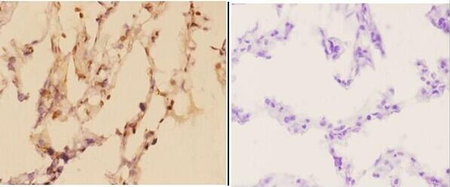 ADARB1 Antibody in Immunohistochemistry (Paraffin) (IHC (P))