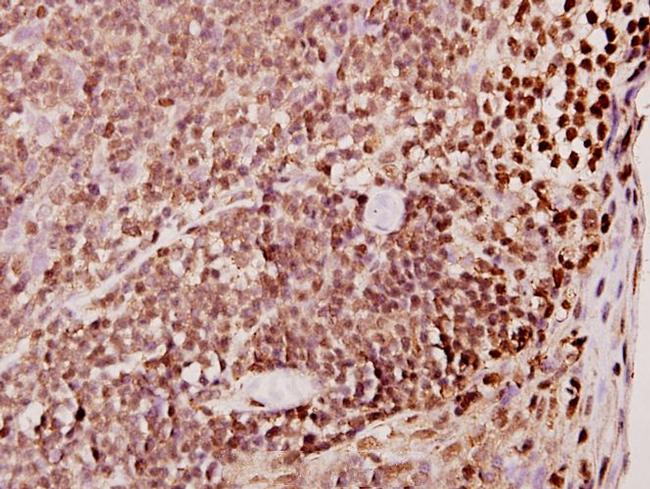 TDE1 Antibody in Immunohistochemistry (Paraffin) (IHC (P))