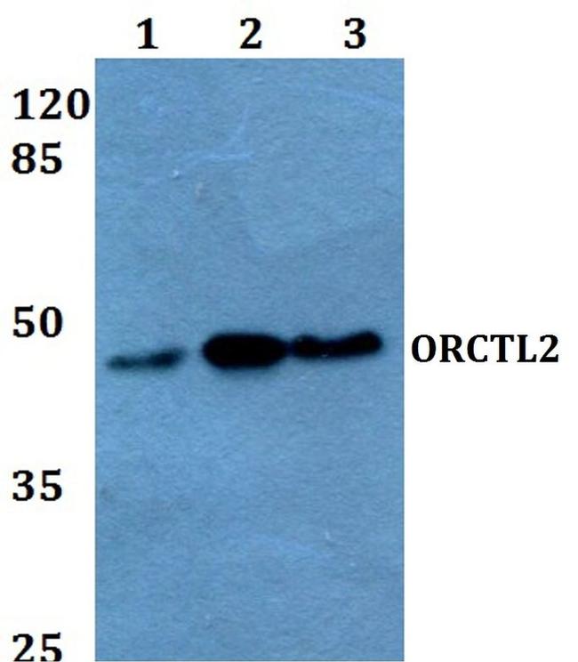 SLC22A18 Antibody in Western Blot (WB)