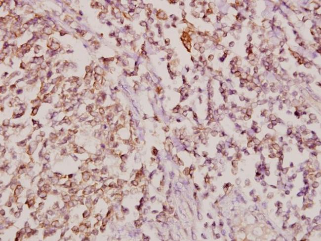 COL11A1 Antibody in Immunohistochemistry (Paraffin) (IHC (P))