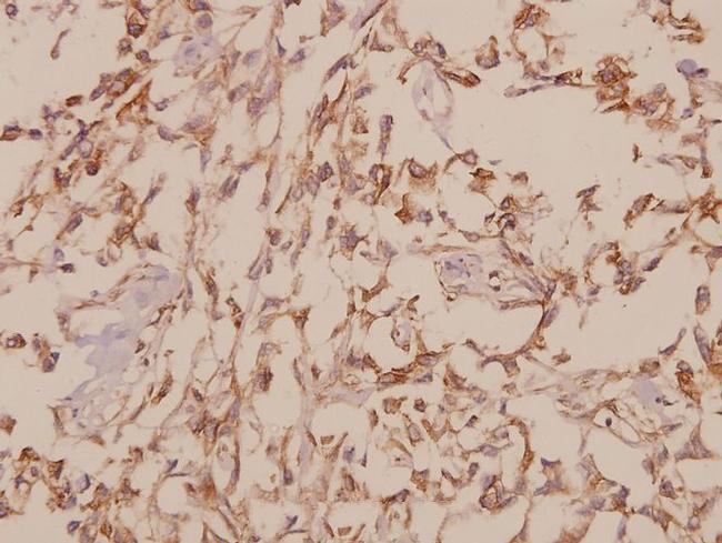 GTF2H1 Antibody in Immunohistochemistry (Paraffin) (IHC (P))