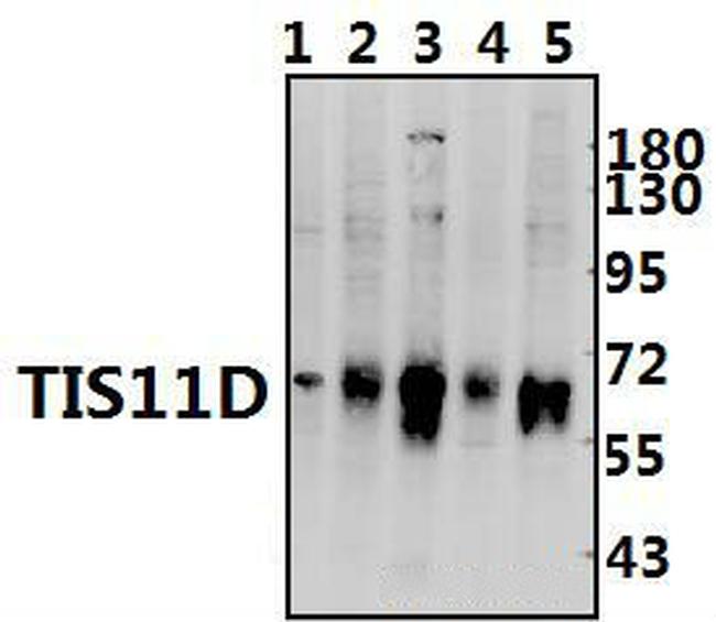 TIS11D Antibody in Western Blot (WB)