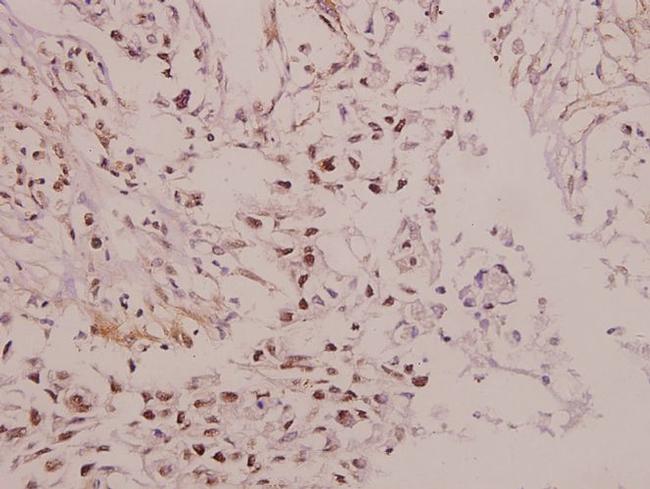 IRX1 Antibody in Immunohistochemistry (Paraffin) (IHC (P))