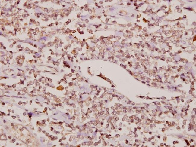 FOXC1/FOXC2 Antibody in Immunohistochemistry (Paraffin) (IHC (P))