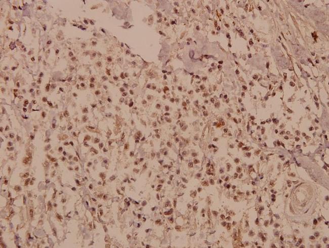 CUG-BP Antibody in Immunohistochemistry (Paraffin) (IHC (P))