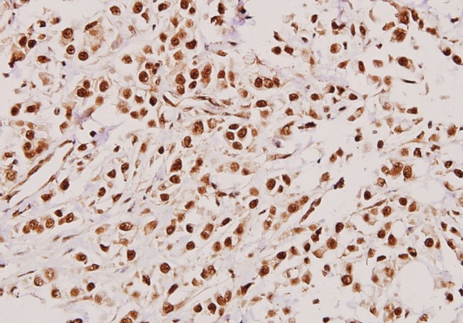 TACC3 Antibody in Immunohistochemistry (Paraffin) (IHC (P))