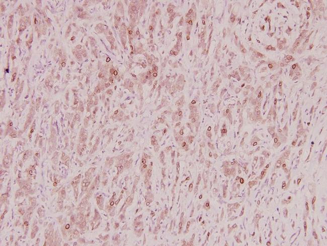 ZNF23 Antibody in Immunohistochemistry (Paraffin) (IHC (P))