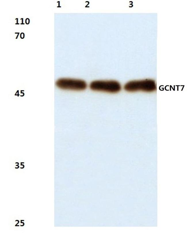 GCNT7 Antibody in Western Blot (WB)