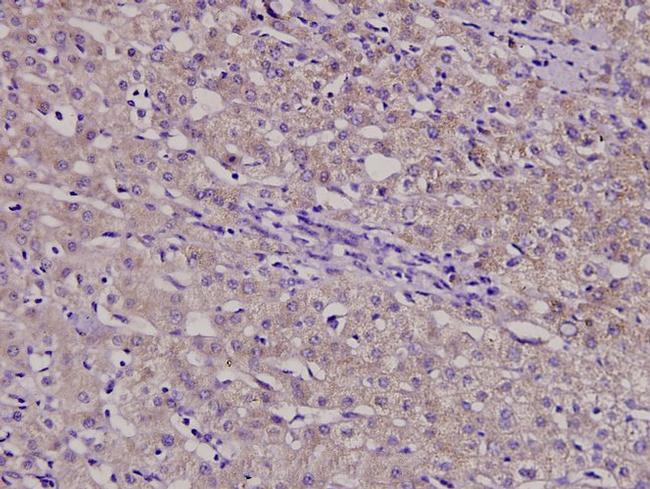 B4GALT3 Antibody in Immunohistochemistry (Paraffin) (IHC (P))