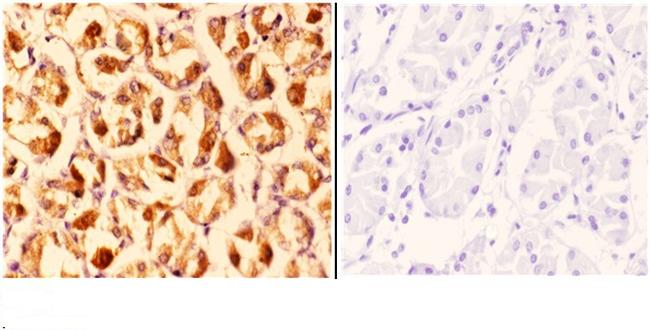 CLN6 Antibody in Immunohistochemistry (Paraffin) (IHC (P))