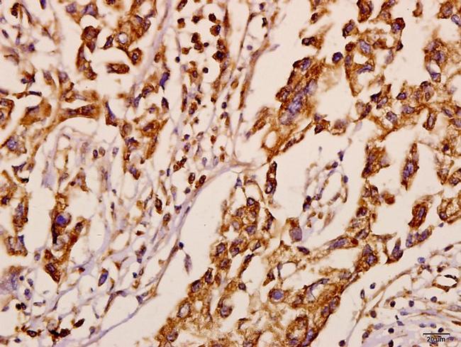 NEURL1 Antibody in Immunohistochemistry (Paraffin) (IHC (P))