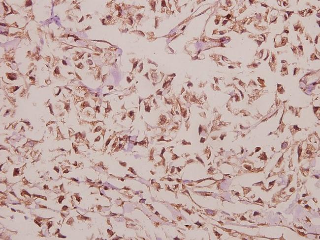 ARRDC4 Antibody in Immunohistochemistry (Paraffin) (IHC (P))