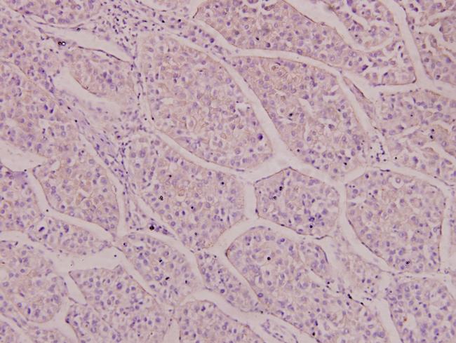 NMDAR2D Antibody in Immunohistochemistry (Paraffin) (IHC (P))