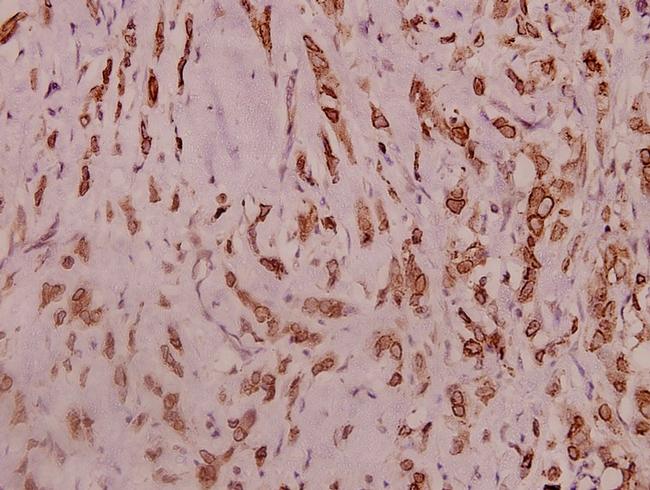 SCN2A Antibody in Immunohistochemistry (Paraffin) (IHC (P))