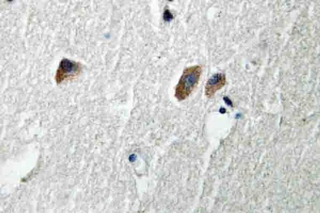 CaMKII beta/gamma/delta Antibody in Immunohistochemistry (Paraffin) (IHC (P))