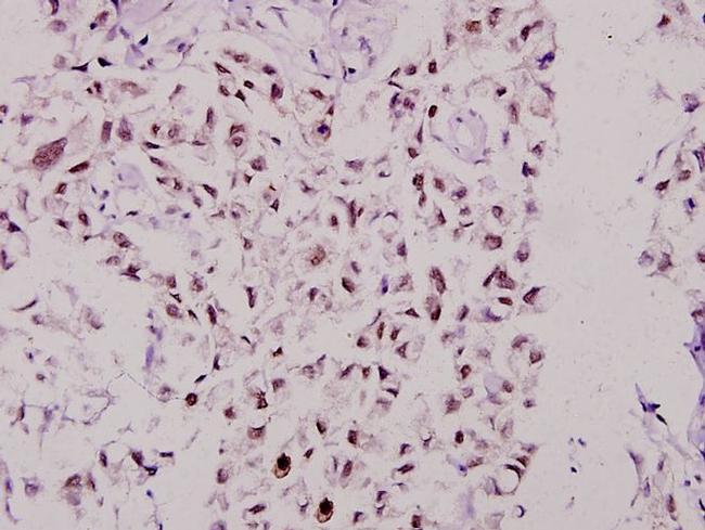 MSK1 Antibody in Immunohistochemistry (Paraffin) (IHC (P))