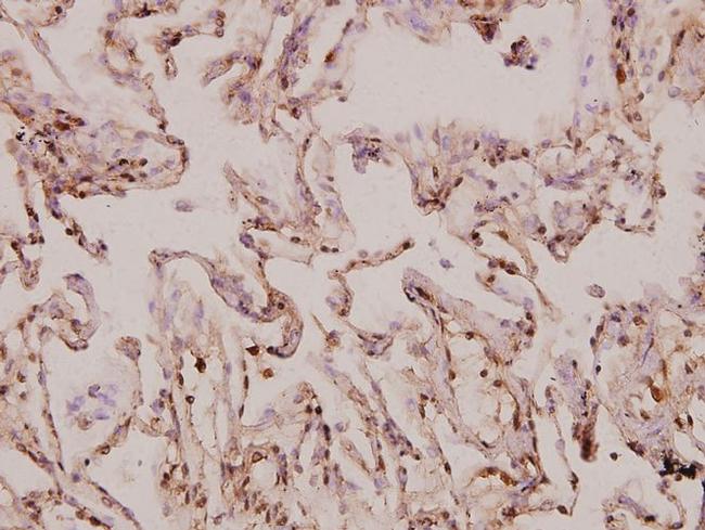 MRPS9 Antibody in Immunohistochemistry (Paraffin) (IHC (P))