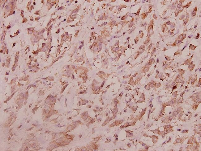 RPL7 Antibody in Immunohistochemistry (Paraffin) (IHC (P))