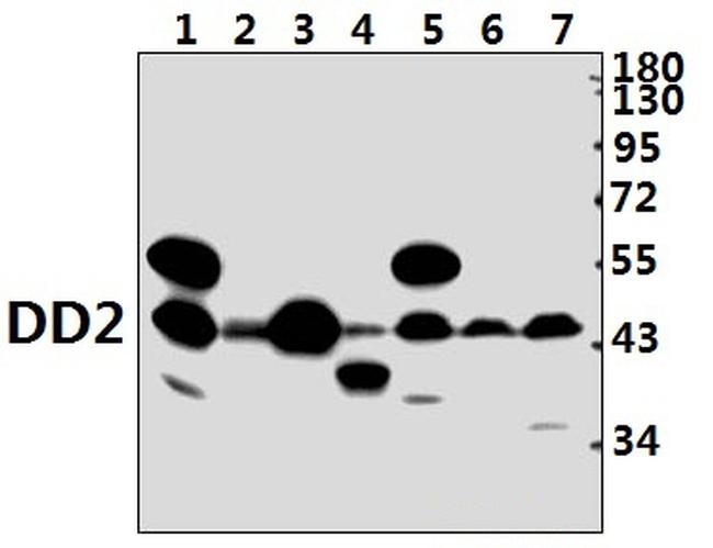 AKR1C2 Antibody in Western Blot (WB)