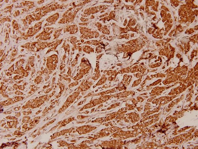 ATP5I Antibody in Immunohistochemistry (Paraffin) (IHC (P))