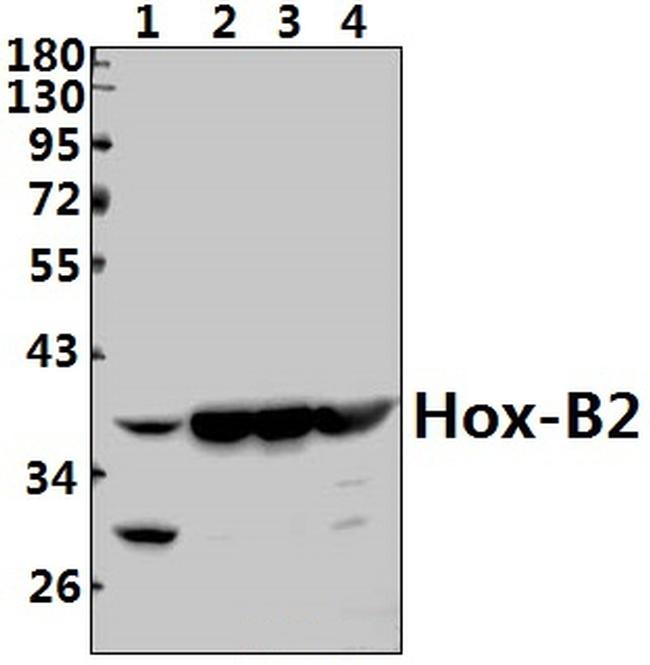 HOXB2 Antibody in Western Blot (WB)