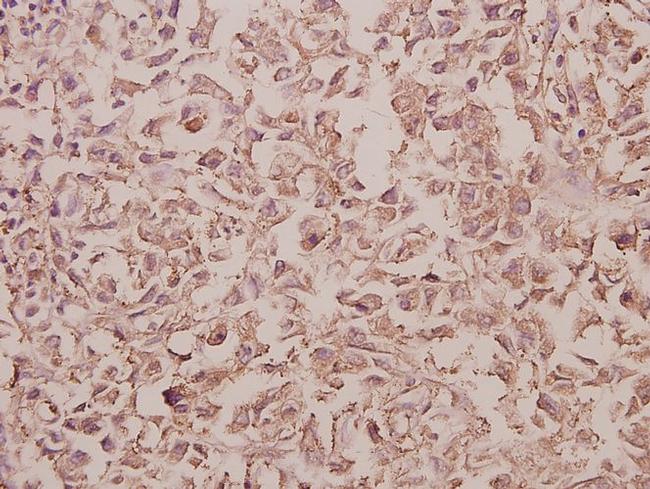 RAB5C Antibody in Immunohistochemistry (Paraffin) (IHC (P))