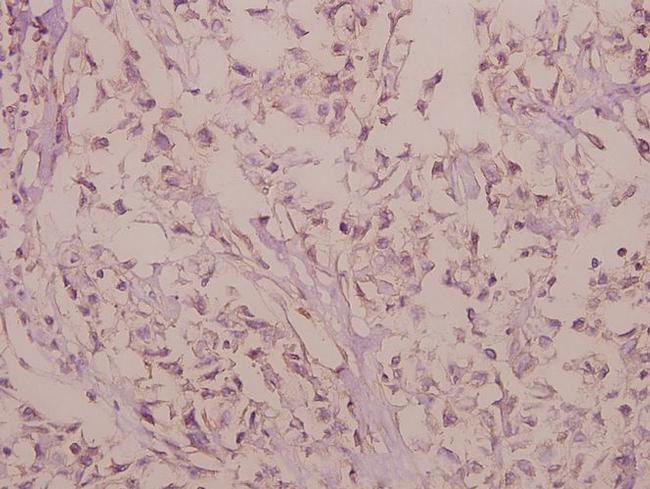 RhoG Antibody in Immunohistochemistry (Paraffin) (IHC (P))