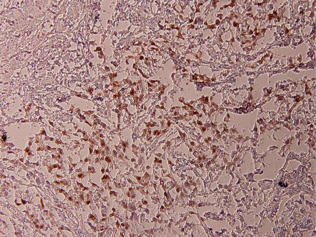 Phospho-ATF2 (Thr69) Antibody in Immunohistochemistry (Paraffin) (IHC (P))