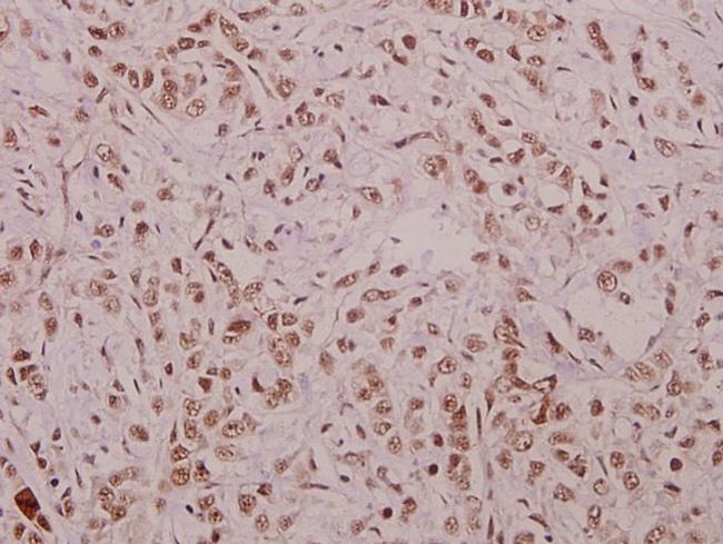 Phospho-Cyclin E (Thr395) Antibody in Immunohistochemistry (Paraffin) (IHC (P))