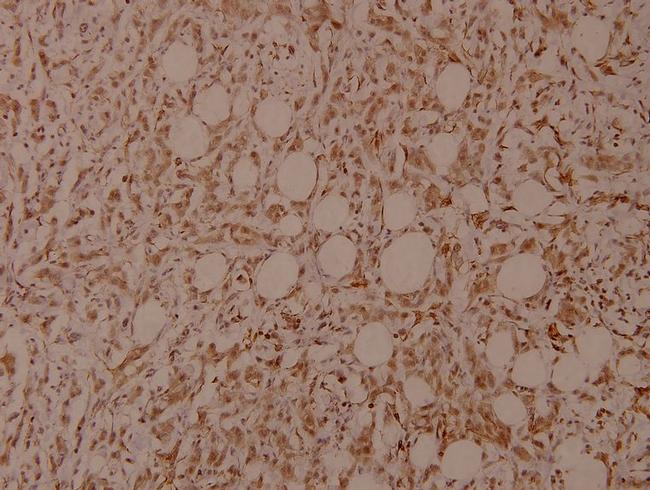 Phospho-Filamin A (Ser2152) Antibody in Immunohistochemistry (Paraffin) (IHC (P))