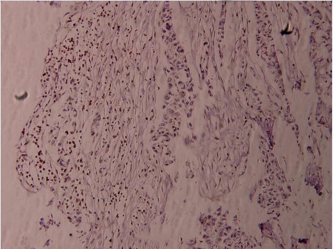 Phospho-Fyn (Tyr530) Antibody in Immunohistochemistry (Paraffin) (IHC (P))