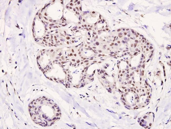 Phospho-HDAC5 (Ser498) Antibody in Immunohistochemistry (Paraffin) (IHC (P))