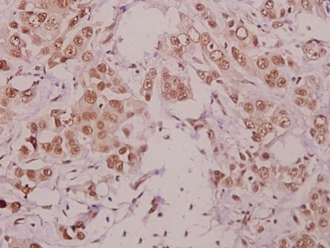 Phospho-IKK alpha (Thr23) Antibody in Immunohistochemistry (Paraffin) (IHC (P))