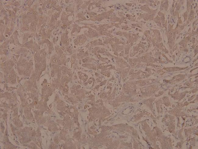 Phospho-JAK1 (Tyr1022) Antibody in Immunohistochemistry (Paraffin) (IHC (P))