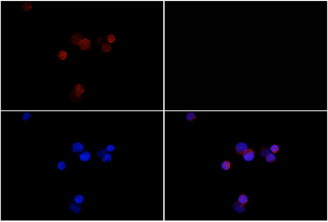 Phospho-JAK2 (Tyr1007) Antibody in Immunocytochemistry (ICC/IF)