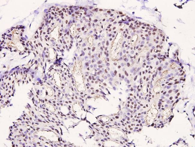 Phospho-LIMK1 (Thr508) Antibody in Immunohistochemistry (Paraffin) (IHC (P))