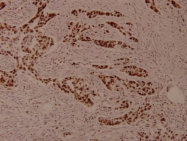 Phospho-MEF2A (Ser408) Antibody in Immunohistochemistry (Paraffin) (IHC (P))