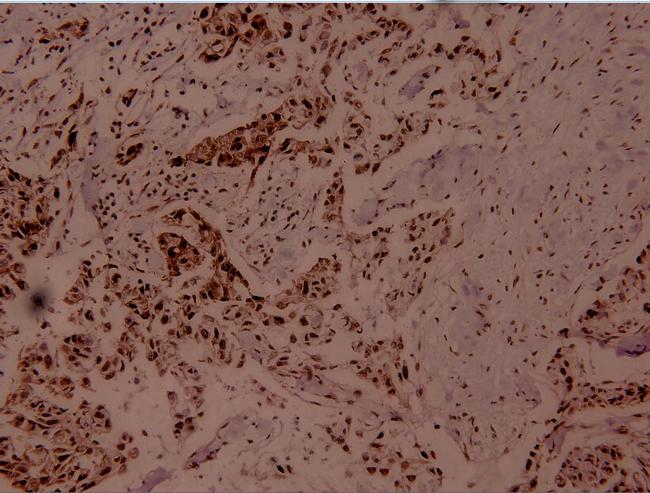 Phospho-MEF2A (Thr312) Antibody in Immunohistochemistry (Paraffin) (IHC (P))