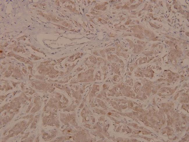 Phospho-MEF2A (Thr319) Antibody in Immunohistochemistry (Paraffin) (IHC (P))