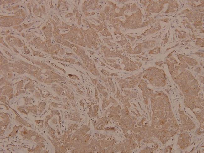 Phospho-MEK6 (Ser207) Antibody in Immunohistochemistry (Paraffin) (IHC (P))