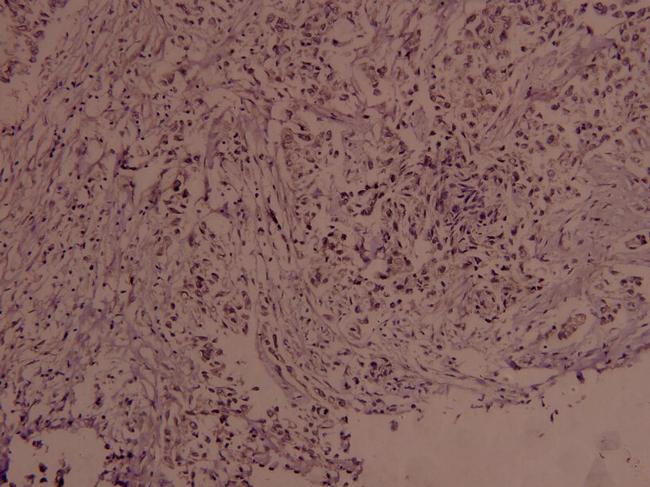 Phospho-c-Myc (Ser373) Antibody in Immunohistochemistry (Paraffin) (IHC (P))