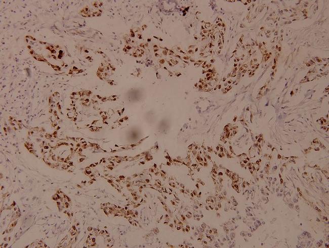 Phospho-c-Myc (Ser62) Antibody in Immunohistochemistry (Paraffin) (IHC (P))