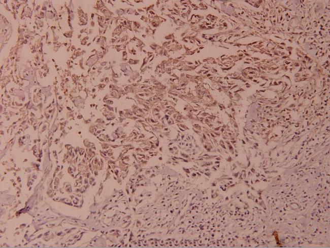 Phospho-NFkB p100 (Ser866) Antibody in Immunohistochemistry (Paraffin) (IHC (P))