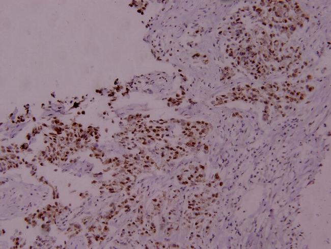 Phospho-STAT5 alpha (Ser780) Antibody in Immunohistochemistry (Paraffin) (IHC (P))