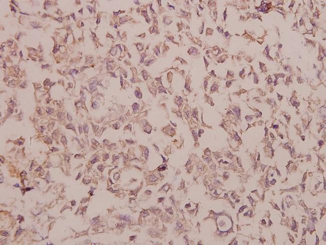 Phospho-IKK alpha/beta (Ser180, Ser181) Antibody in Immunohistochemistry (Paraffin) (IHC (P))