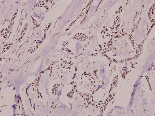 Phospho-Ku80 (Thr714) Antibody in Immunohistochemistry (Paraffin) (IHC (P))